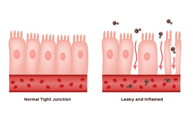 Compare Junction